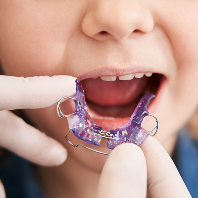 Dentista-Infantil---Ortodoncia Interceptiva